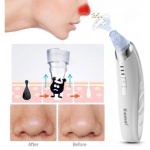 Συσκευή για βαθύ καθαρισμό προσώπου - KM-1868 - Kemei - Image 3